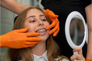 teeth braces types - fixed braces
