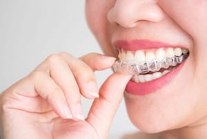 how does Invisalign move teeth